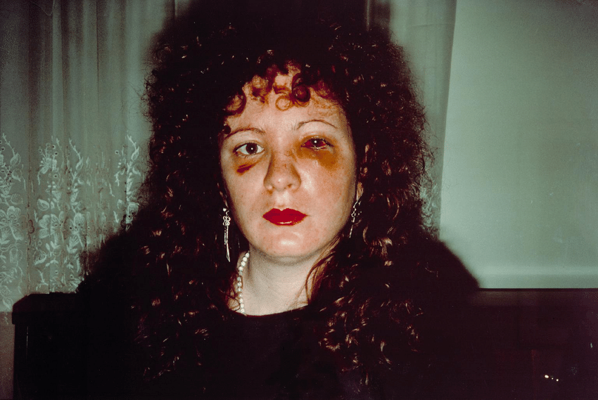 Nan Goldin, Nan one month after being battered, 1984